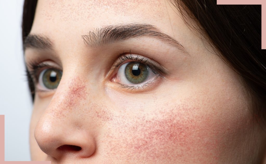 November 25 BLOG Images 14